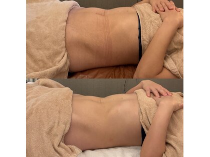 ミエリー(miely)の写真