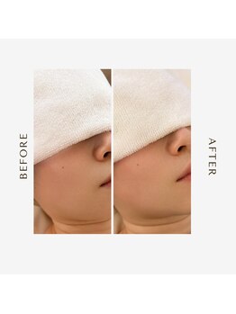 オーシャン(OCEAN)/ムートン&リッチ