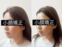 ルピナス 立川店の雰囲気（小顔矯正で骨格美人♪直後でわかる変化にリピート率90%超え！）