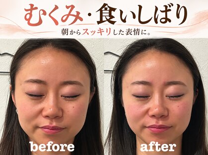 ソラナ(Solana)の写真