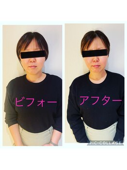 ピュアン(Purene)/