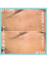 ジュネラ ボーテ(Jenela beaute)/美肌育成