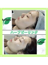 グランディールアン(GRANDIR UN)/ハーブピーリング