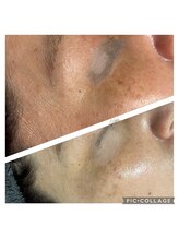 サイ(Sai)/春のゆらぎ肌！