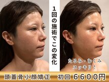 グレースフィオーレ 南越谷店(gracefiore)