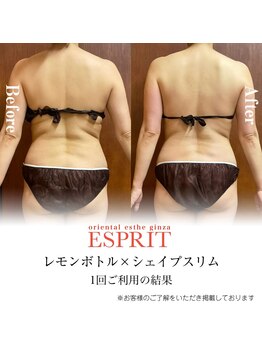 エスプリ 銀座店/驚きのレモンボトル1回の結果