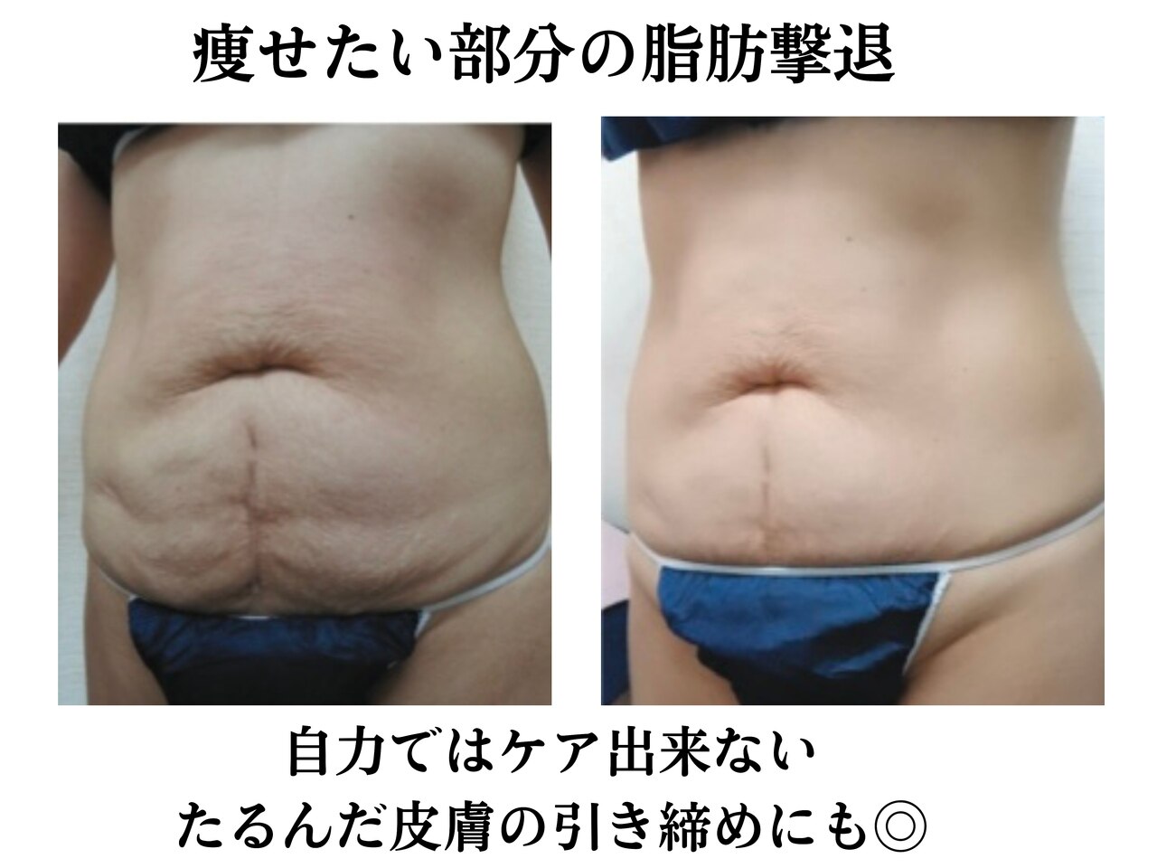 スパイア(SPIRE)｜ホットペッパービューティー