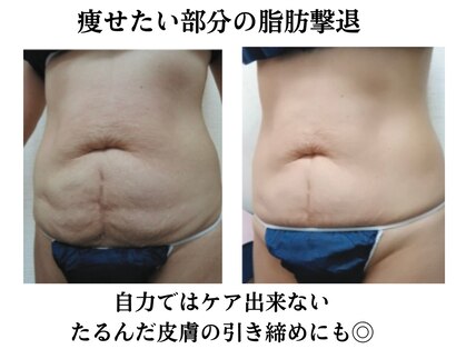 スパイア(SPIRE)の写真