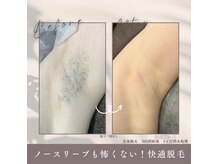 モアトゥインクル 五日市駅前店(MORE twinkle)