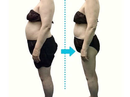 セルフエステBB あけのアクロス店の写真