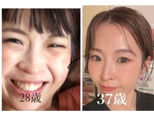 ディアンヌ(Diane)の雰囲気（[衝撃before＆after]見た目ー10歳！むくみ冷え体質.産後ー19kg）