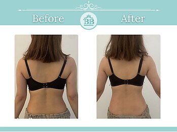 美人バスト 辻堂店/バストを残してダイエット
