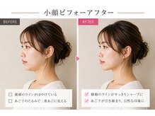 ベアフット(BARE FOOT)/1回で力みをほどく