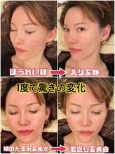 スペチアーレ 夙川/小顔も美肌も同時になれる！