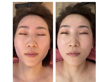 クラルスシンメトリーサロン 高槻店(Clarus Symmetry Salon)/小顔特化コース♪