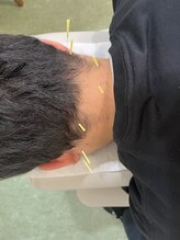 鳴門坂口鍼灸整骨院/鍼灸施術