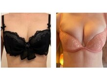 エスビューティー 三軒茶屋(S beauty)/バストケア・三軒茶屋・痩身