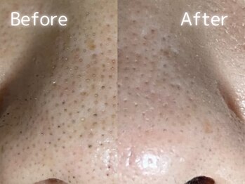 ザ プレザント 大倉山(the pleasant)/クリスティーナのビオフィート