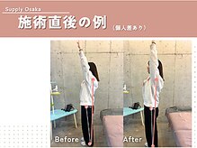 福ト整体院/施術変化の例（個人差あり）