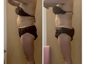 ココア(CoCoa)/活性リンパ洗浄