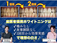ホワイトニングショップ くずは店