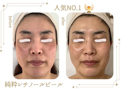 カンパニュラ(campanula)の写真