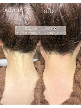 コモレビ(komorebi)/