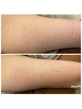 カリーノ(CARINO)/