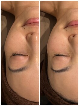 ファビリス 天王寺店(FAVILIS)/ハイドロスプラッシュ1回/30代