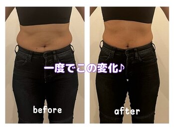 ヨサパーク カルム(YOSA PARK)/一度でこの変化♪