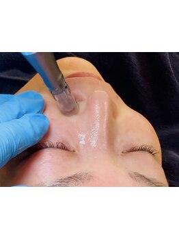 毛穴ケアをしたい