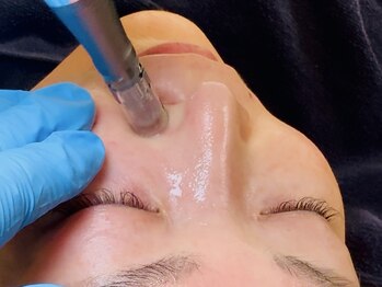 トータルクリア(TOTAL CLEAR)の写真/日本での取り扱い希少!美容大国韓国で人気の高級エステ【SUPERJECTION】で自信の持てるすっぴんへ♪