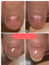 ケアリ(CAREri)/ジェルネイルでの育成も◎