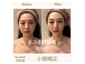 スカーレット 北参道(Scarlett)