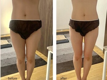 ヨサパーク 新百合ヶ丘店(YOSA PARK)/【before&after】