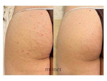 モネ(monet)/グリーンピールボディ 1枚分