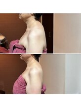 ミーシェ(Me shine)/一度で姿勢改善♪背肉スッキリ