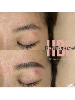 エリス(ELISSE)/ハリウッドブロウリフト