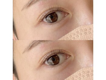 アンベリール(embellir)/