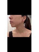 サロン ド ミニョン(salon de mignon)/美肌も小顔も手に入れたい♪