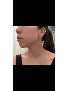 サロン ド ミニョン(salon de mignon)/美肌も小顔も手に入れたい♪