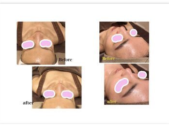 バニーヒップ(Bunny Hip)/カーボキシー