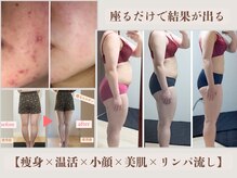 ヨサパーク スノー(YOSA PARK snow)の雰囲気（結果重視。顔、足、体、全身しっかり効果が出ます。）