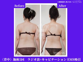 フェレザ 新潟(Felleza)/EMS-電気刺激