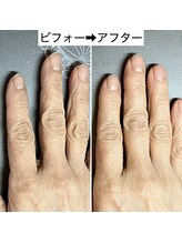 桃の木 吉祥寺店/手の潤い補給♪専門店ハンドケア