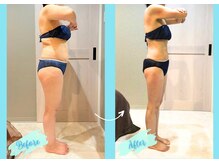 千歳の女神 岡崎店/【施術風景】Before/After