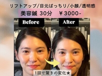 松山鍼灸マッサージ院の写真