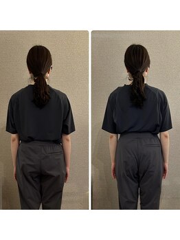 アメノチハレ(ame nochi hare)/年齢に抗える体とお顔に!