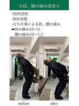 オルカ整体院(ORCA整体院)/【鹿児島/肩こり】