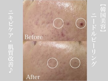 サロン ウルハ(Salon Uruha)/シミたるみケア